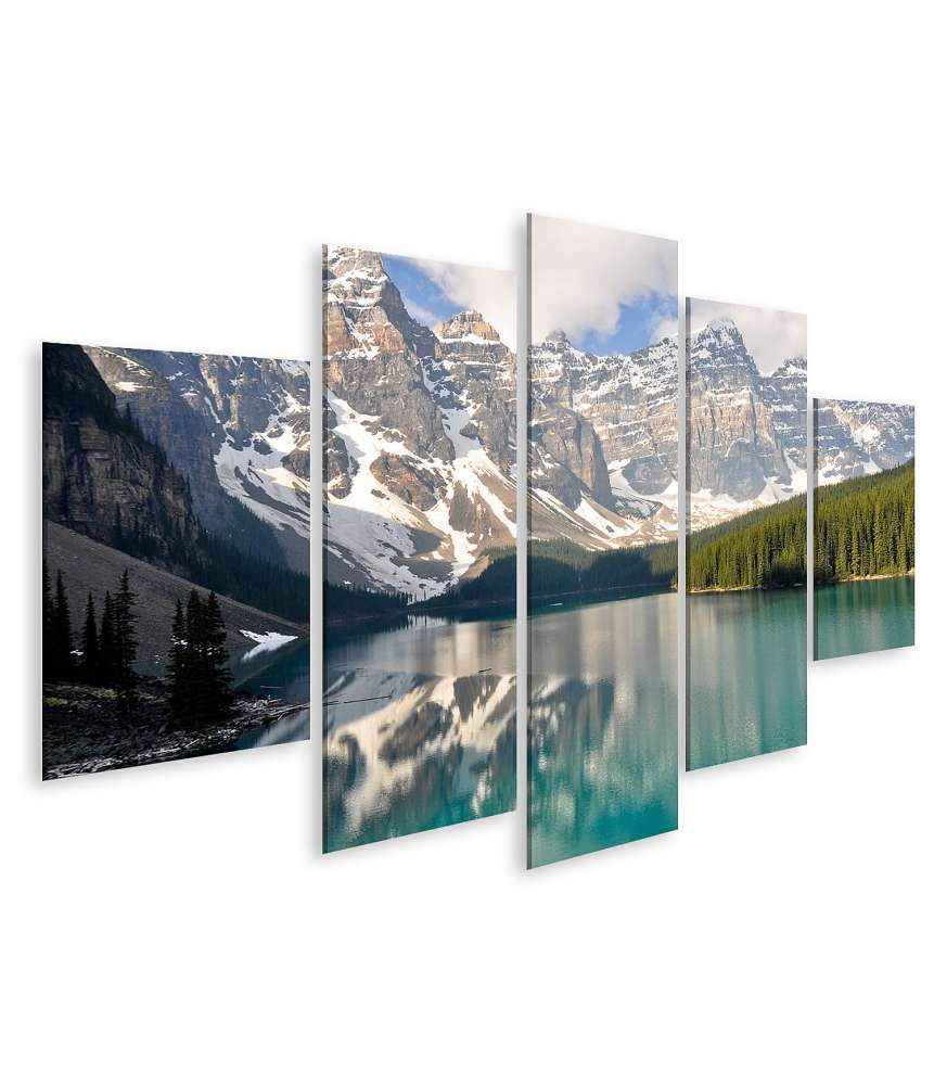 Islandburner Bild auf Leinwand Atemberaubendes Wandbild von Moraine Lake in den Rocky Mountains, Kanada